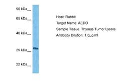ADO Rabbit anti-Human, Polyclonal, Novus Biologicals 0.1ml; Unconjugated:Antibodies,